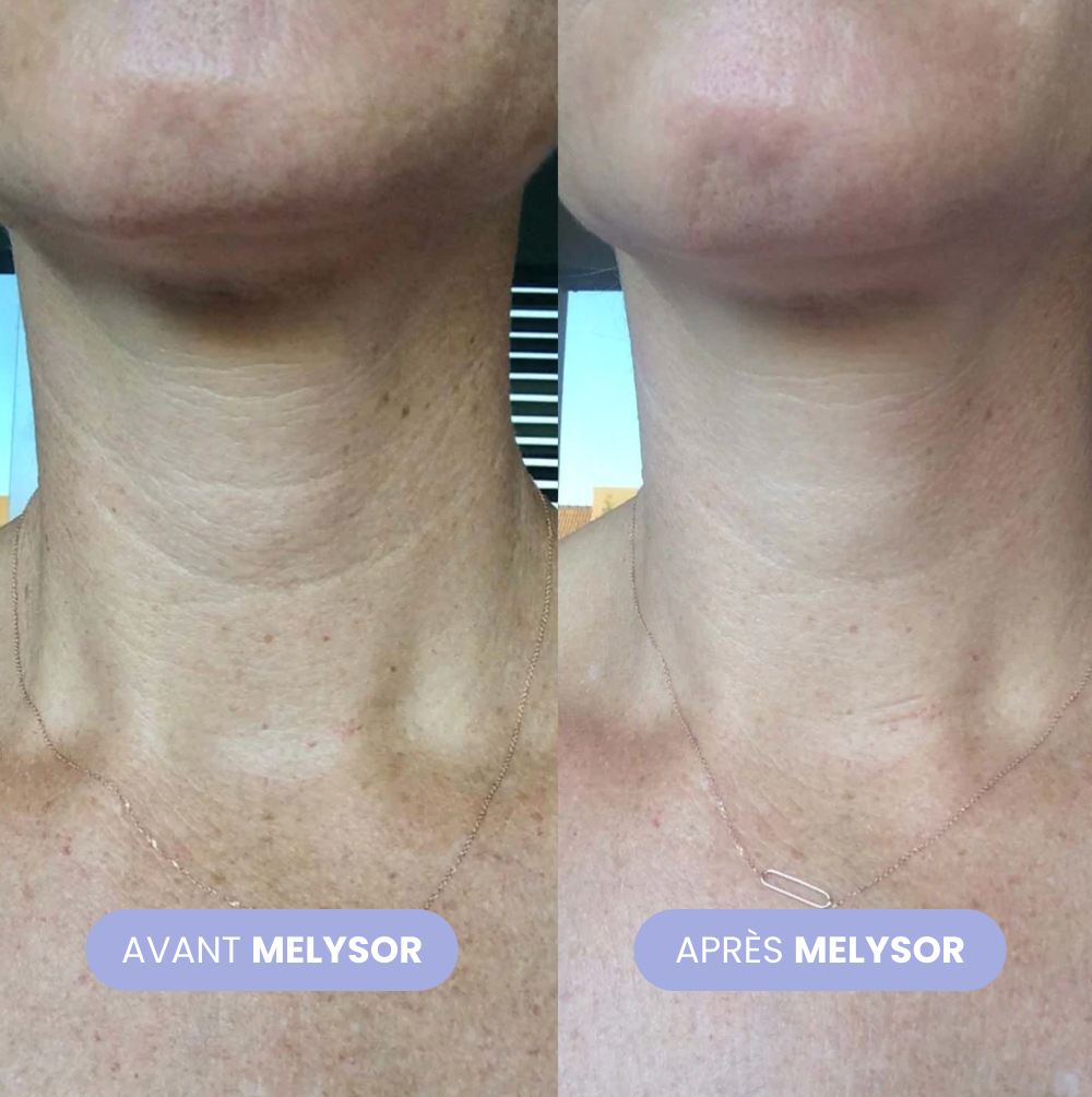 Crema per il collo