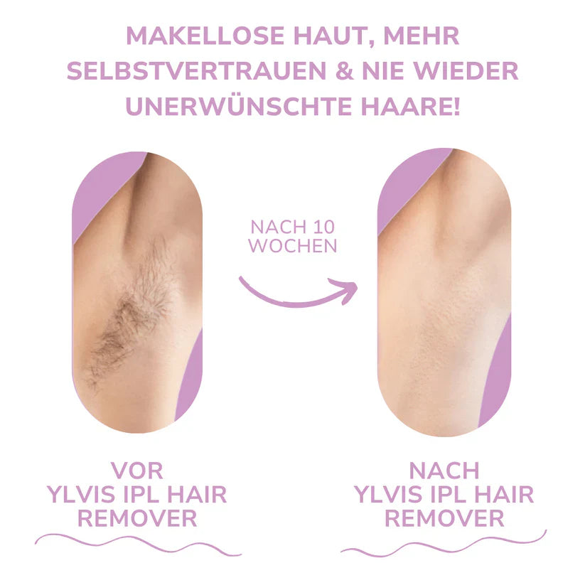 Ylvis IPL Haarentferner
