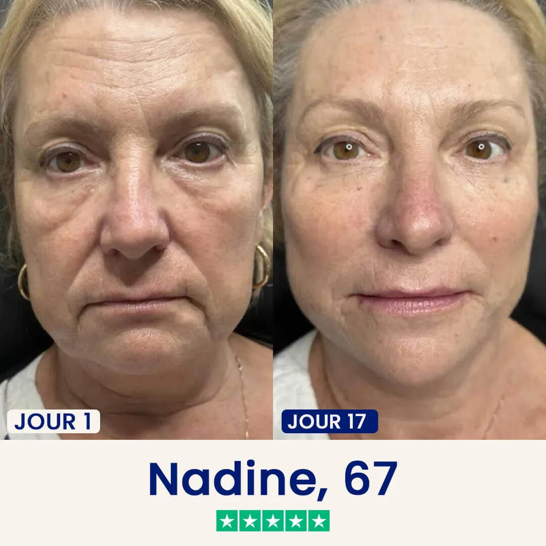 Maschera rassodante antidoppio mento