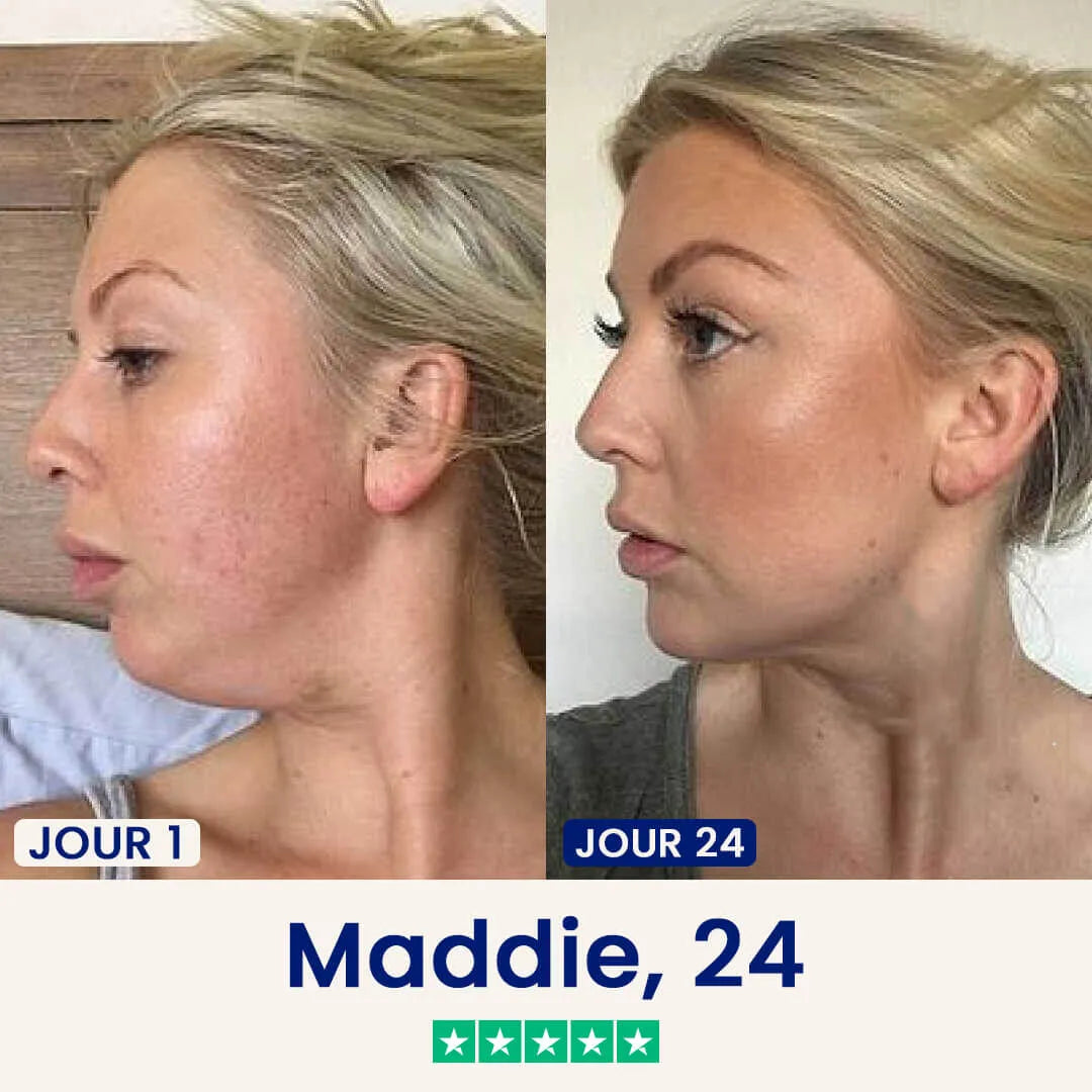 Maschera rassodante antidoppio mento