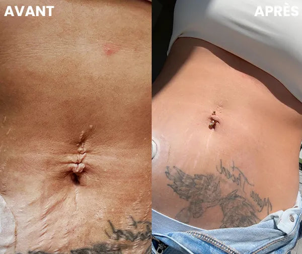 Cintura terapeutica a luce rossa