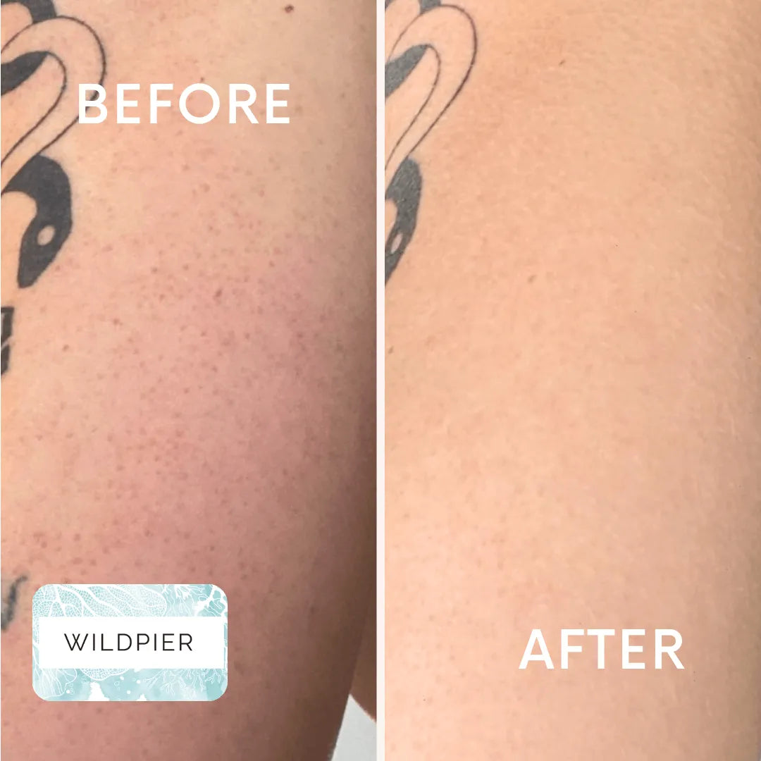 Guanto esfoliante - Rimuove la pelle morta