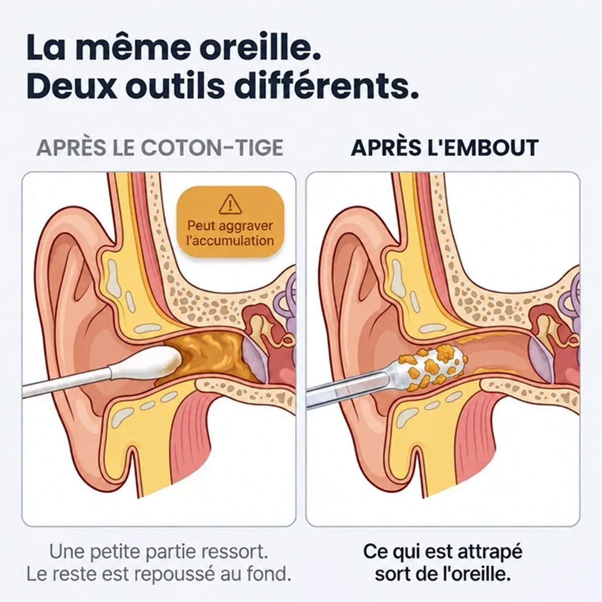 Nettoyeur d’oreilles adhésif réutilisable