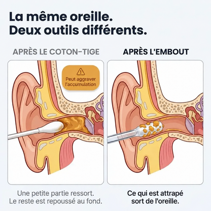 Nettoyeur d’oreilles adhésif réutilisable