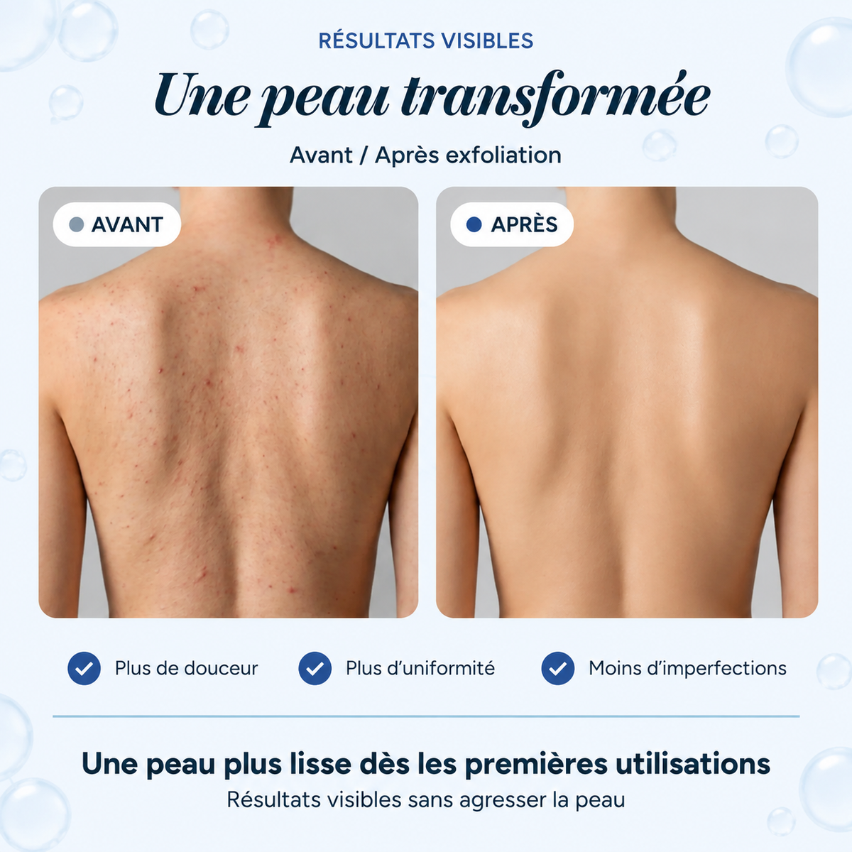 Serviette exfoliante corps longue