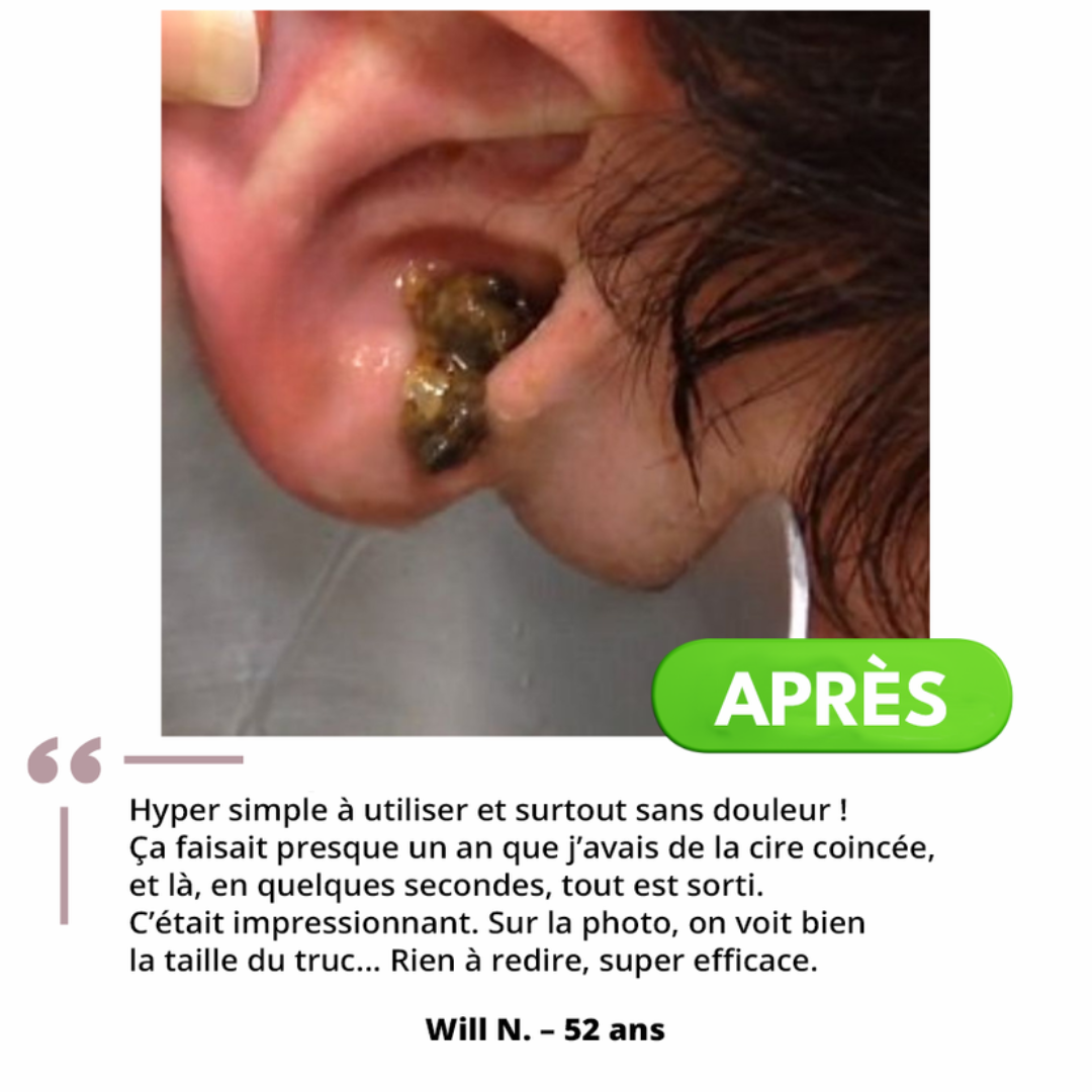 Nettoyant auriculaire doux et efficace