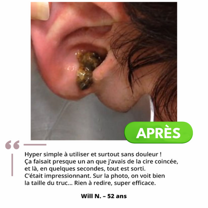 Nettoyant auriculaire doux et efficace
