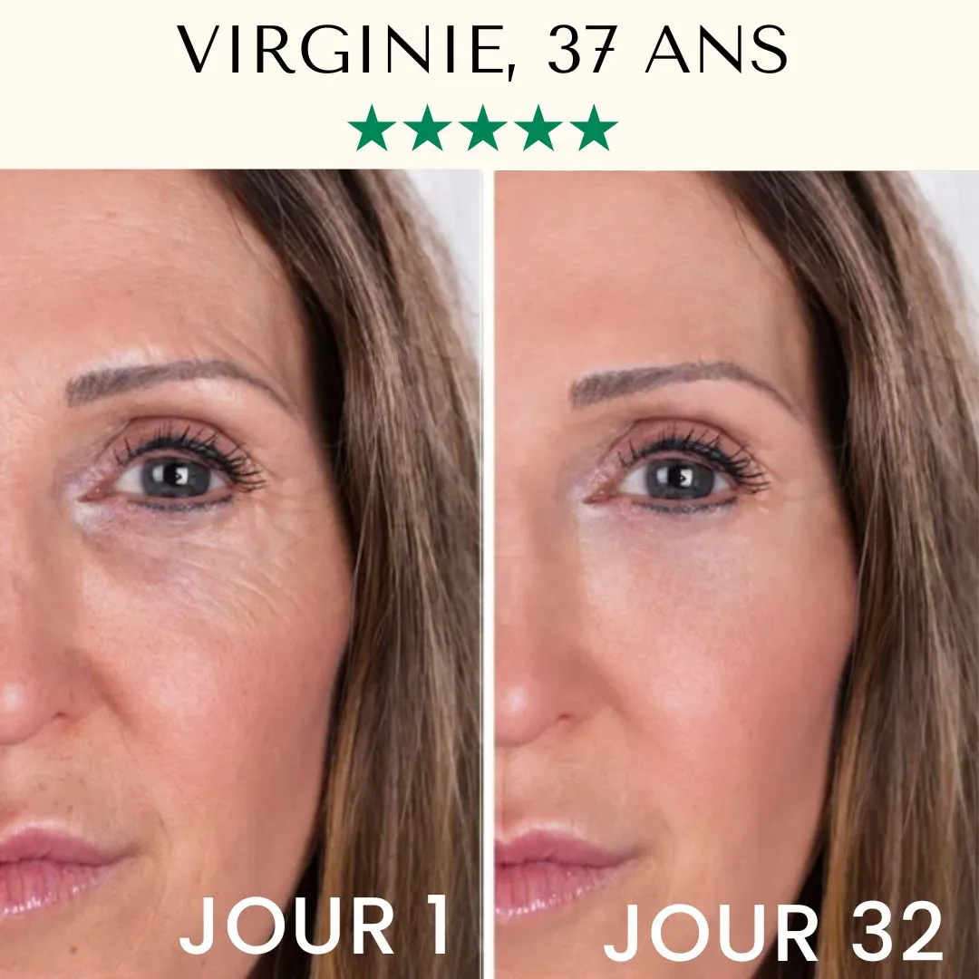 Appareil nettoyant visage à ultrasons