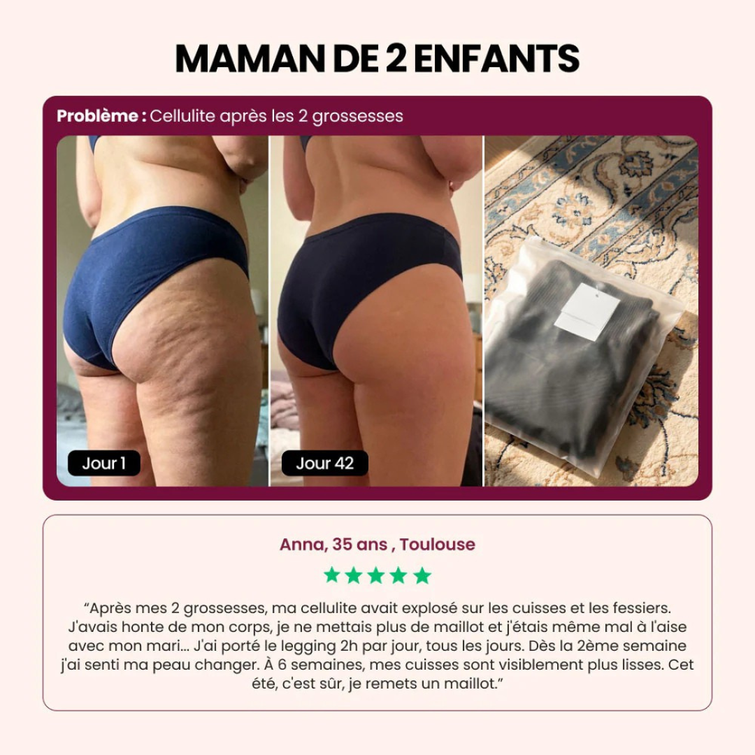 3D-Leggings zur Körperformung gegen Cellulite