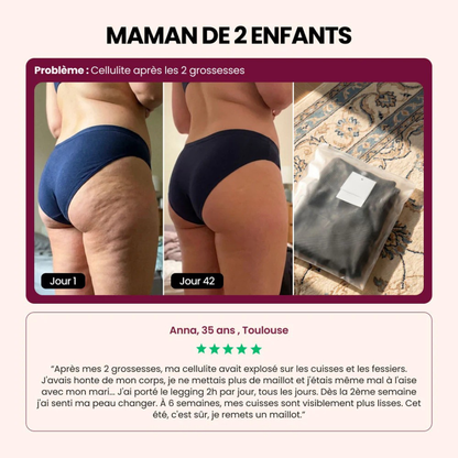 3D-Leggings zur Körperformung gegen Cellulite
