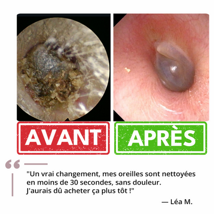Nettoyant auriculaire doux et efficace