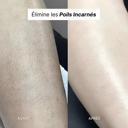 Rasoir Électrique Précision
