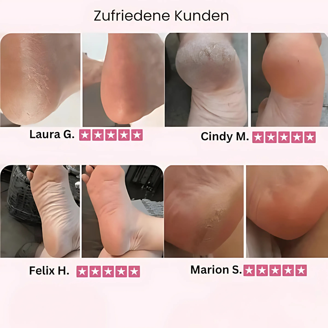 Elektrischer Hornhautentferner für sanfte Fußpflege