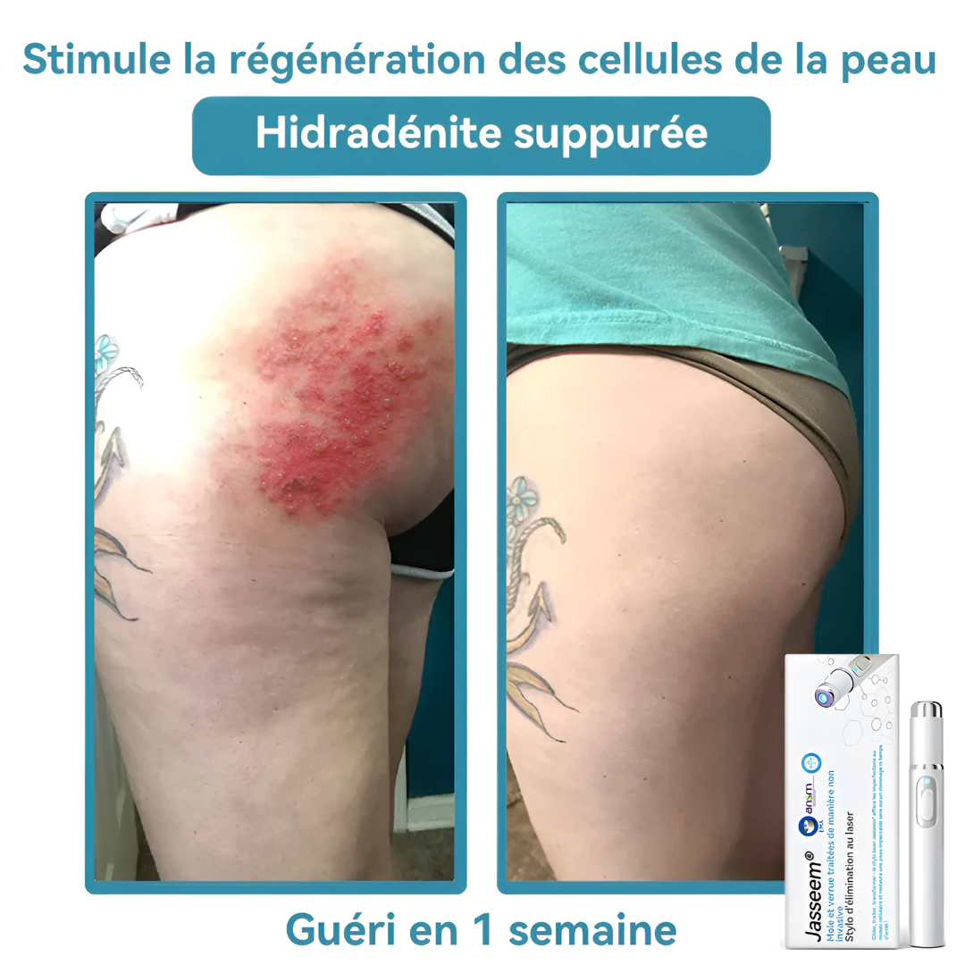 Stylo Soin Anti-Taches