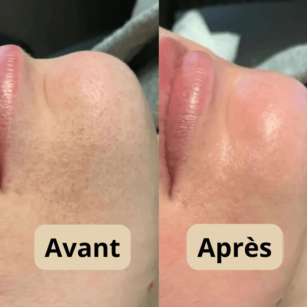 Sérum Gommant au Riz – Pour Peaux Sensibles