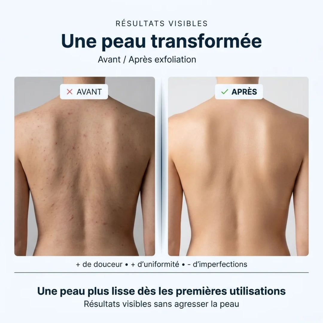Serviette Exfoliante Corps Anti-Rugosités pour Peau Lisse