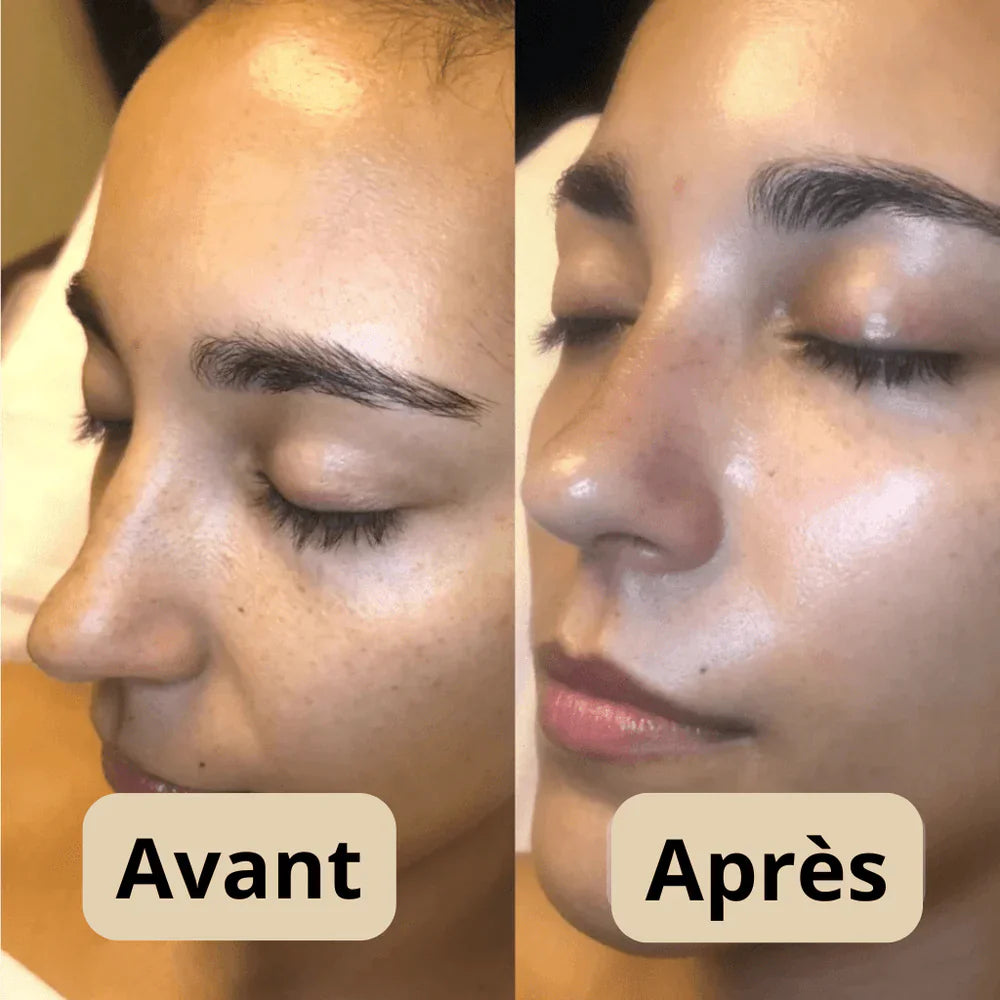 Sérum Gommant au Riz – Pour Peaux Sensibles