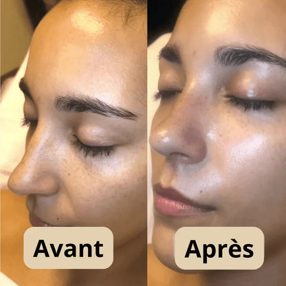 Sérum Gommant au Riz – Pour Peaux Sensibles