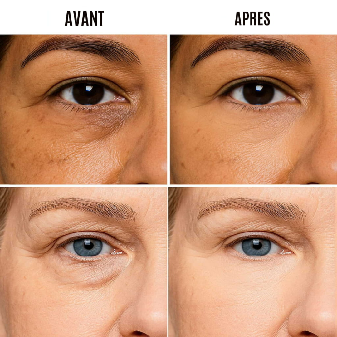 LumEyes Soin des yeux