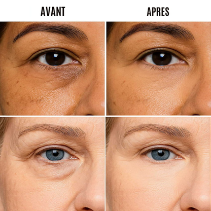 LumEyes Soin des yeux