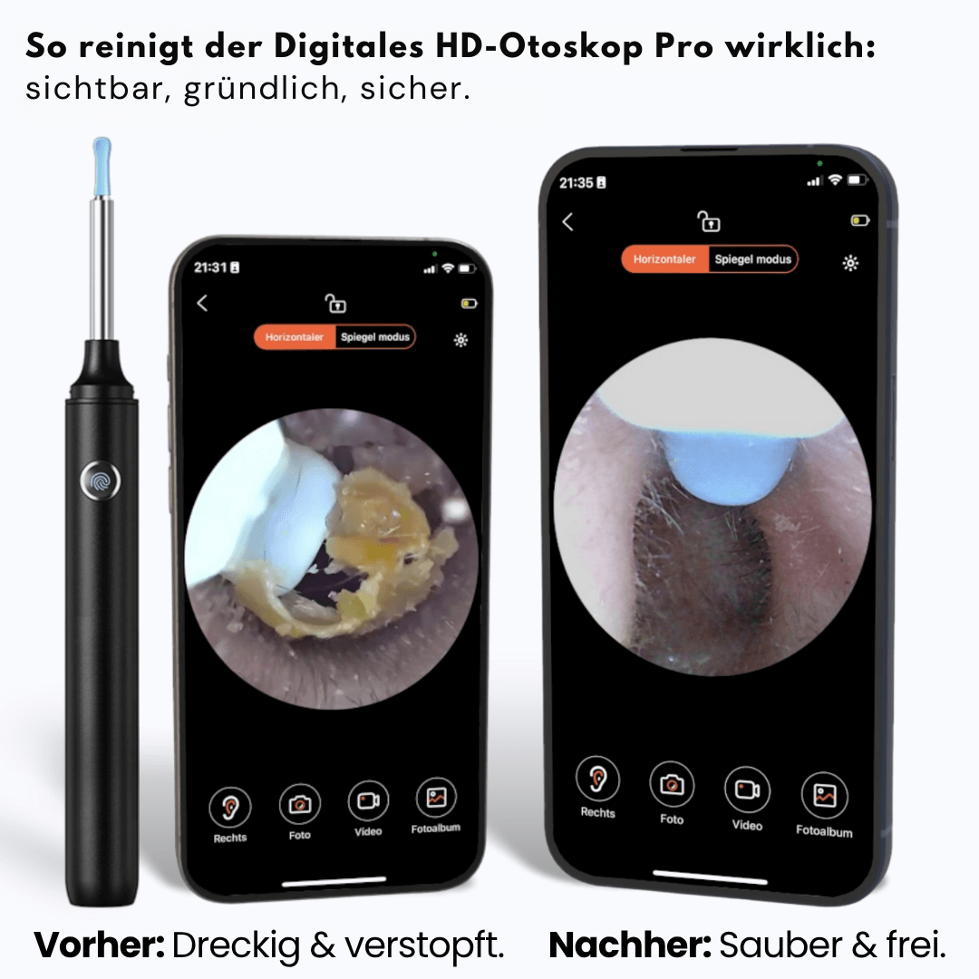 Otoscope numérique HD