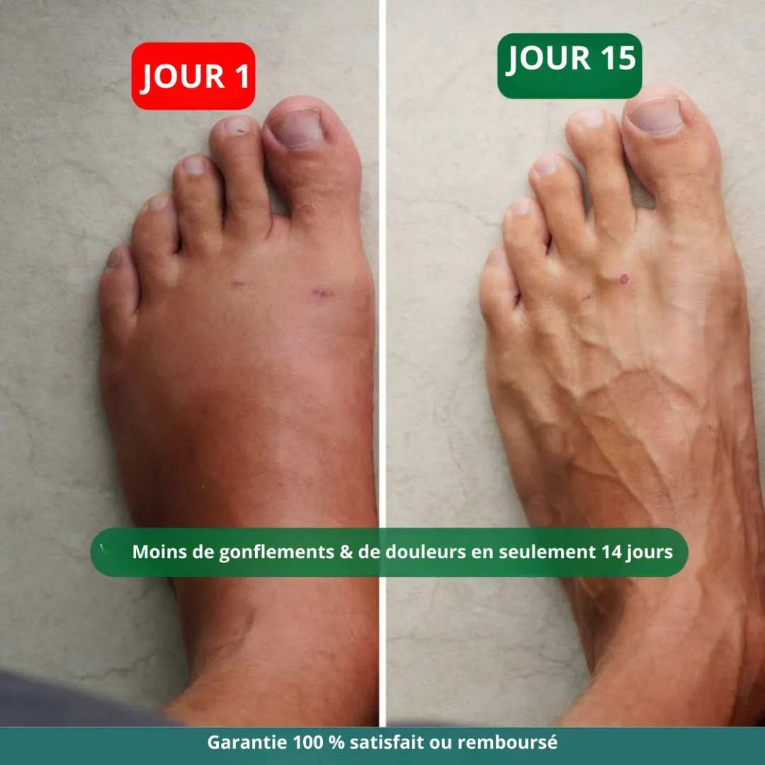 Chaussettes de Contention Large