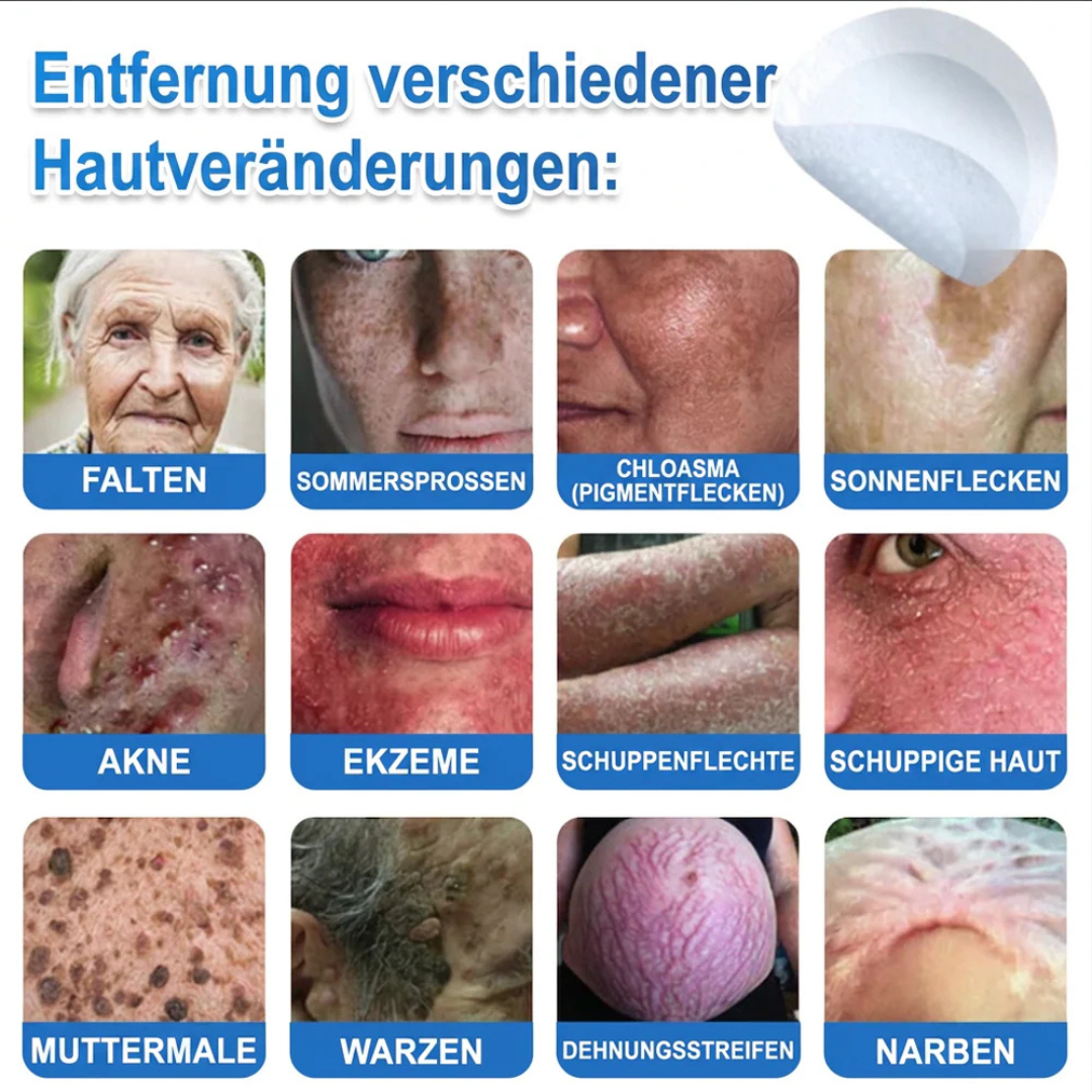Patchs micro-aiguilles anti-boutons et imperfections visage