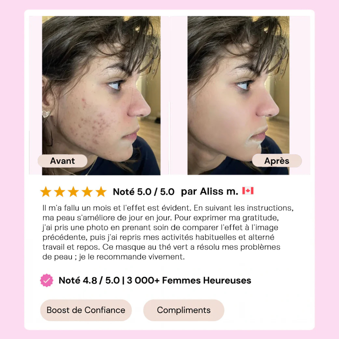 Masque Solide au Thé Vert
