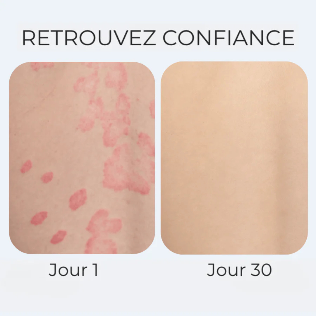 Crème anti-démangeaisons naturelle multi-zones