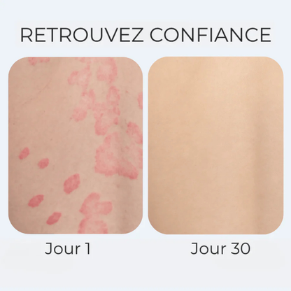 Crème anti-démangeaisons naturelle multi-zones