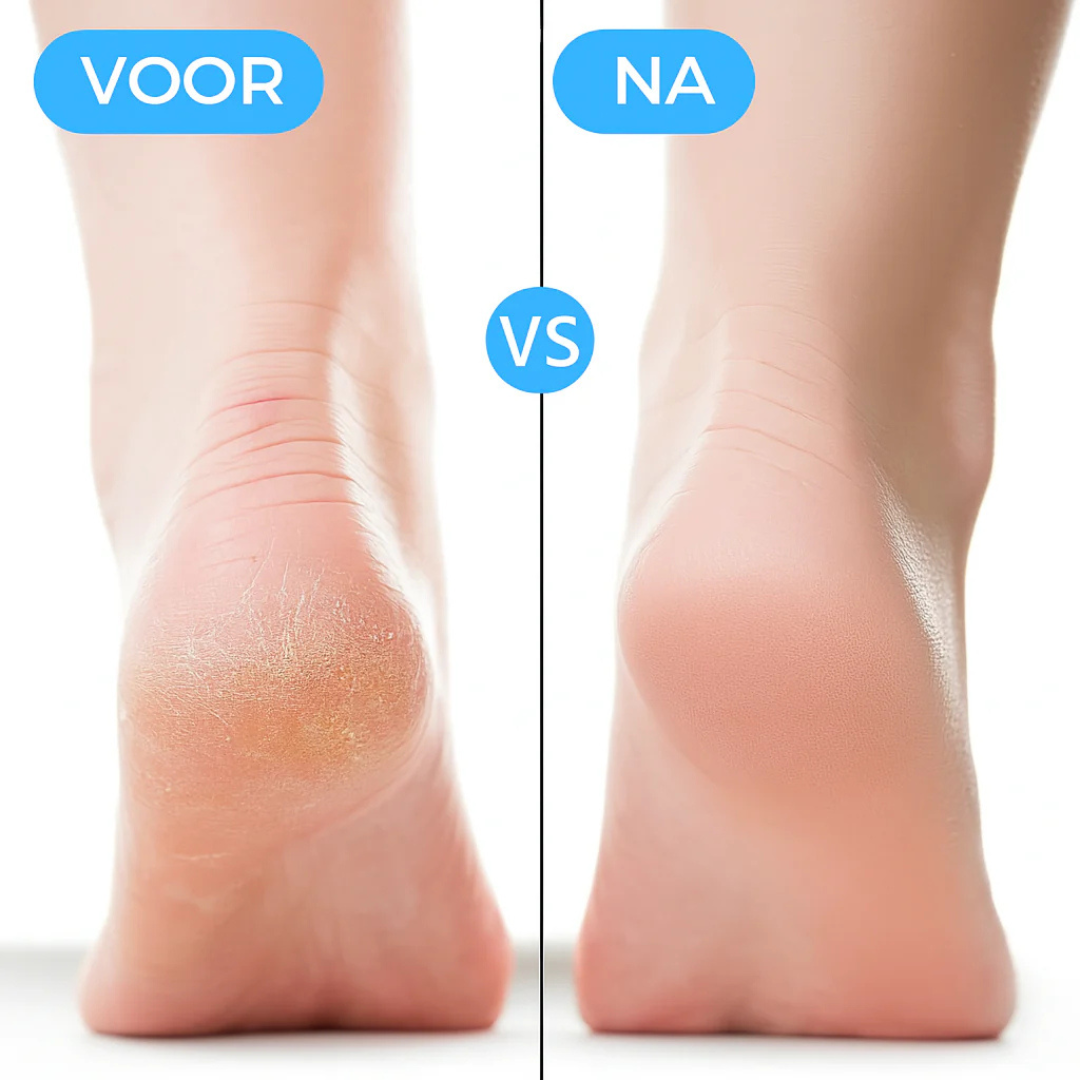 Protecteurs de talons en silicone avec coussin d’air