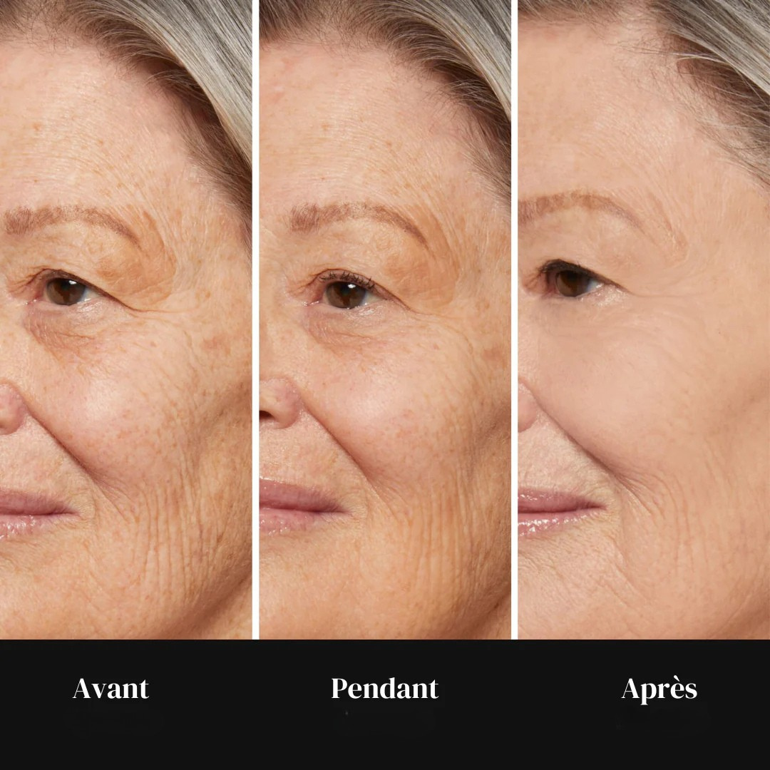 Sofortige Anti-Falten-Pflege