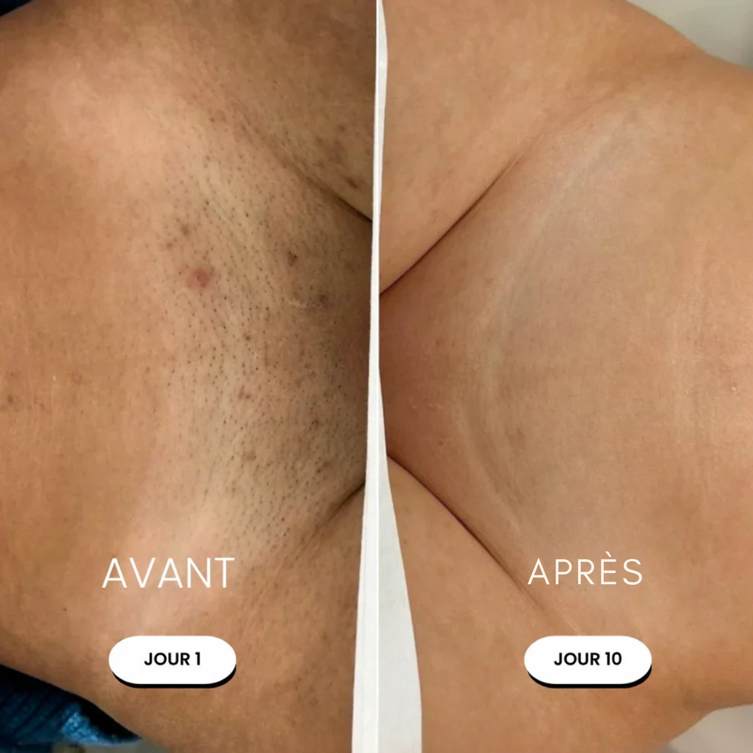 Rasoir électrique femme – Douceur express sans irritation