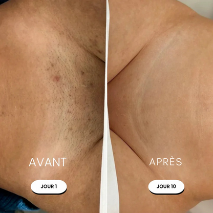 Rasoir électrique femme – Douceur express sans irritation