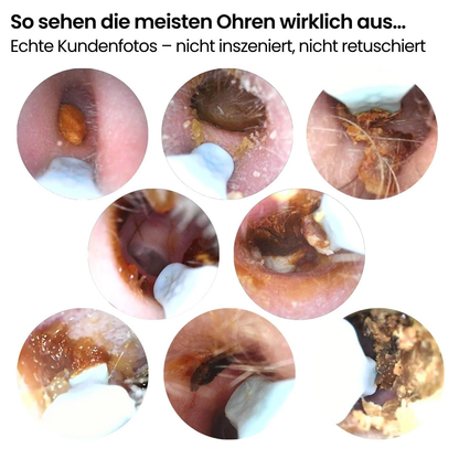 Nettoyeur d’Oreilles Visuel HD avec Caméra Intégrée