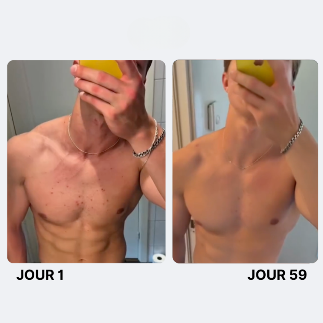 Savon Purifiant Anti-Acné