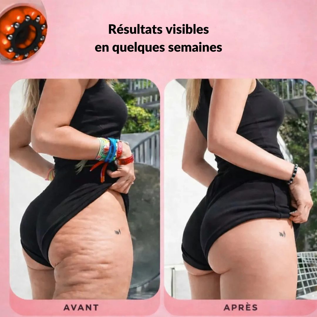 Beheiztes Anti-Cellulite-Gerät