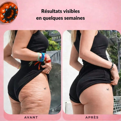Beheiztes Anti-Cellulite-Gerät