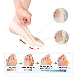 Vitality™ - Orthèses Hallux Valgus