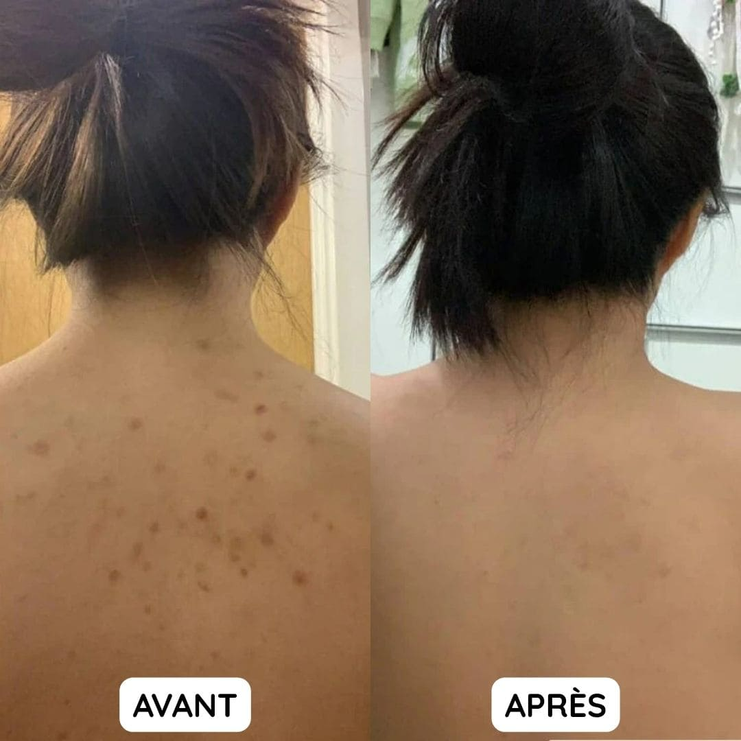 Serviette Exfoliante pour Douche