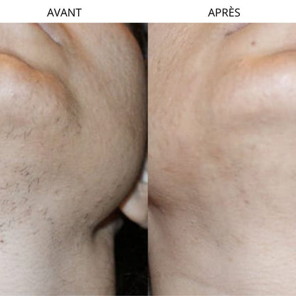 Rasoir électrique indolore pour une épilation douce et efficace