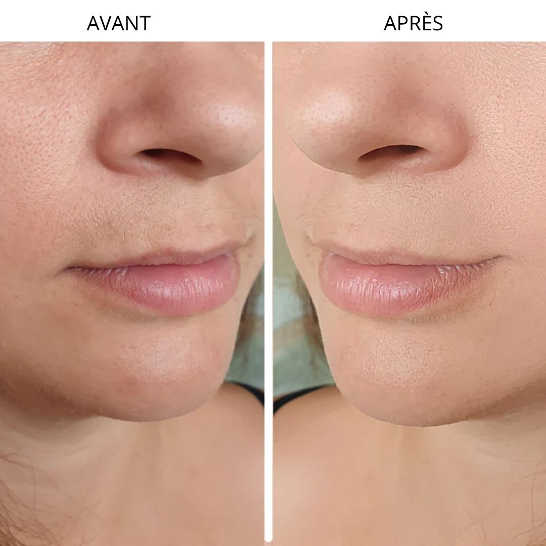 Rasoir électrique indolore pour une épilation douce et efficace