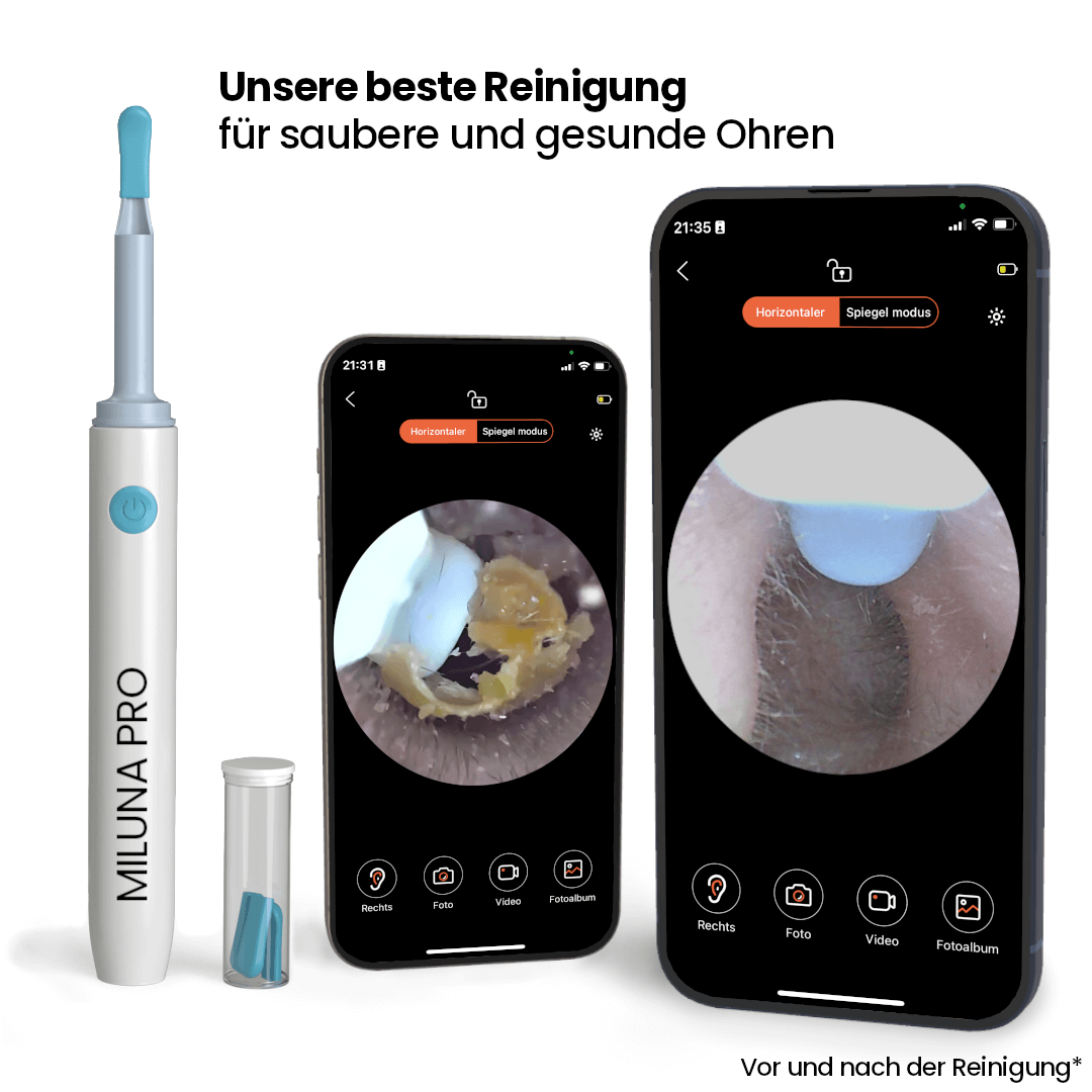 Miluna™ Pro – Intelligenter Ohrenreiniger mit HD-Kamera