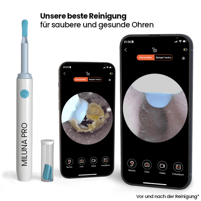 Miluna™ Pro – Intelligenter Ohrenreiniger mit HD-Kamera