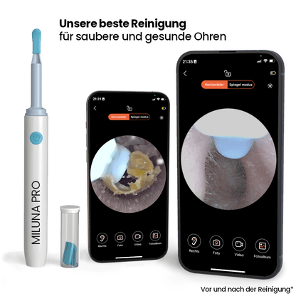 MilunaPro – Intelligenter Ohrreiniger mit HD-Kamera