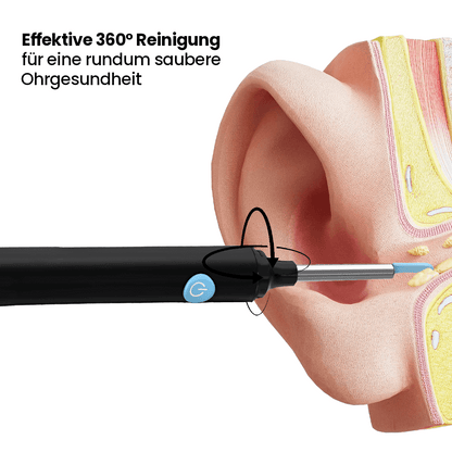 Miluna™ Pro – Intelligenter Ohrenreiniger mit HD-Kamera