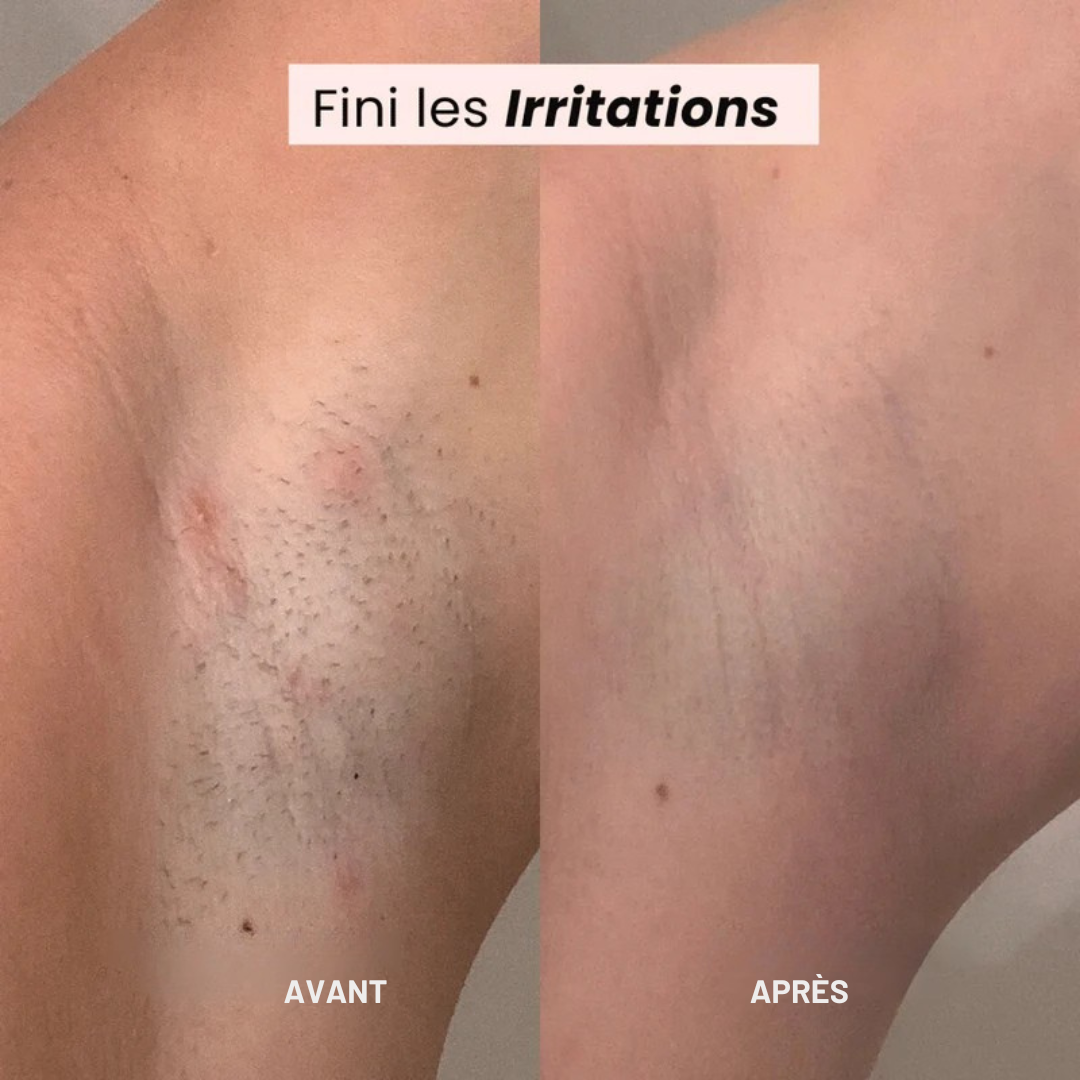 Rasoir électrique 2-en-1 pour peau lisse et sans irritation