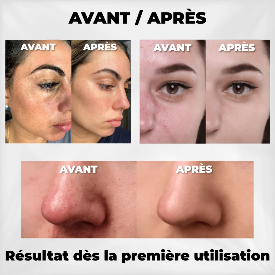 Exfoliant pour le visage au riz noir