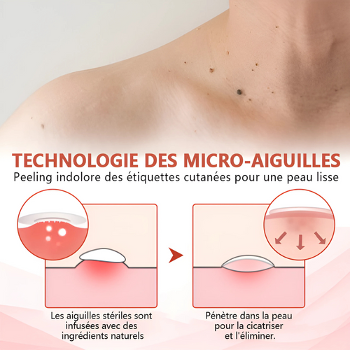 Patch Anti-Douleur MicroPatch