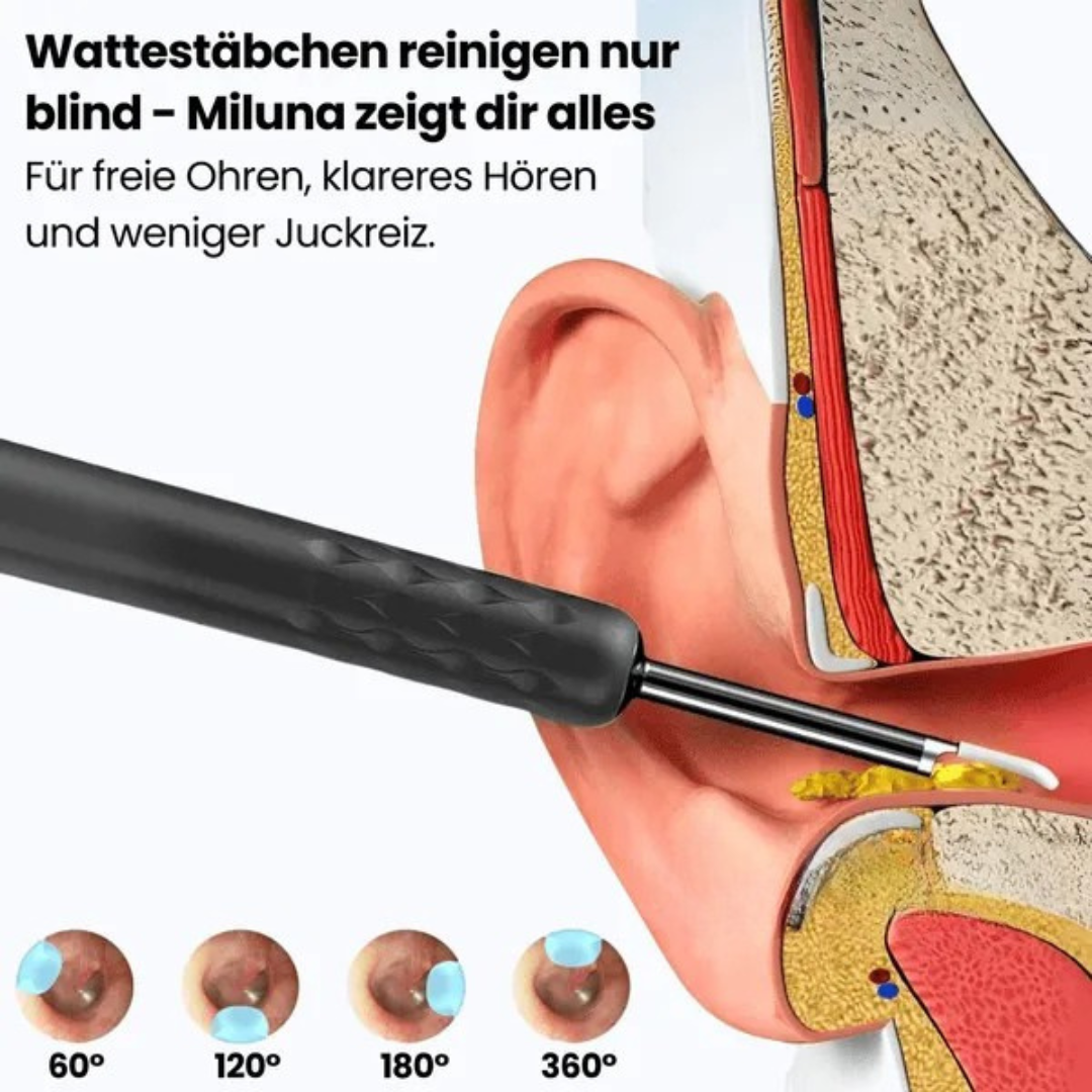 Otoscope numérique HD